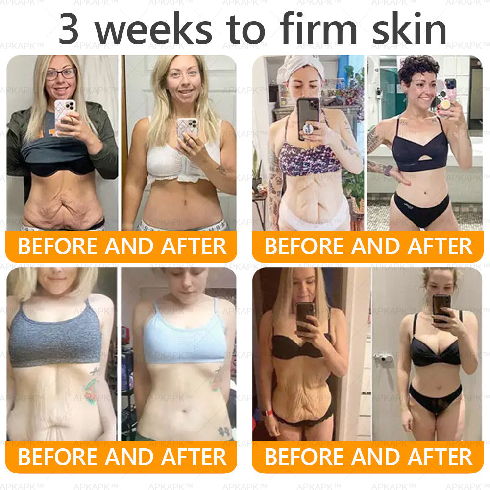 Made and Shipped from USA ✨ LBMLBM™ Bee venom Comprehensive Cream 🔥 LAST DAY 80% OFF）