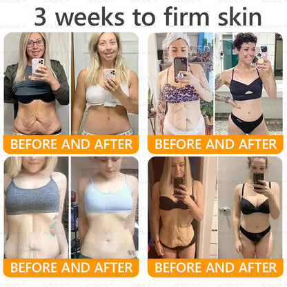 Made and Shipped from USA ✨ LBMLBM™ Bee venom Comprehensive Cream 🔥 LAST DAY 80% OFF）