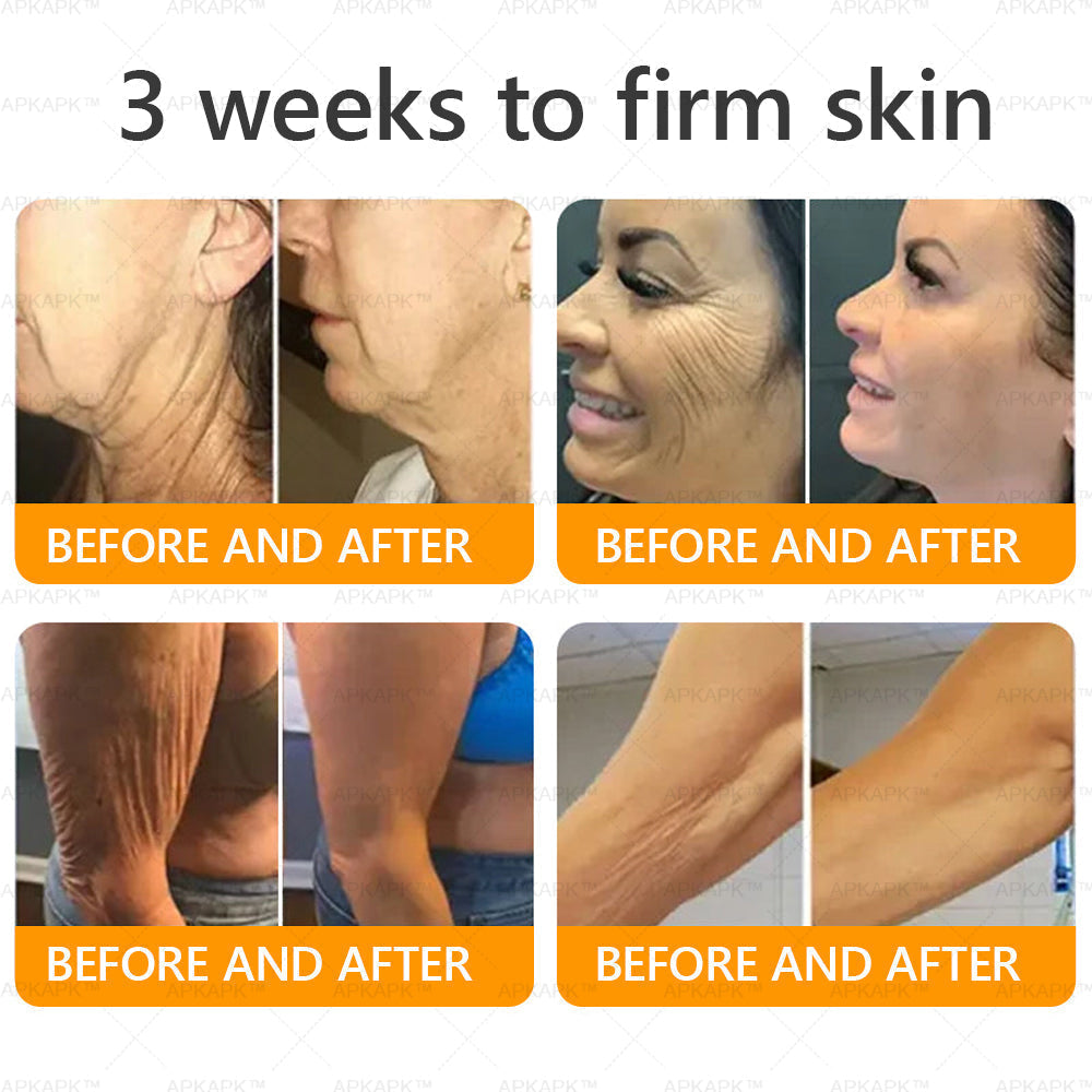 Made and Shipped from USA ✨ LBMLBM™ Bee venom Comprehensive Cream 🔥 LAST DAY 80% OFF）