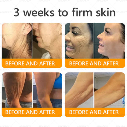 Made and Shipped from USA ✨ LBMLBM™ Bee venom Comprehensive Cream 🔥 LAST DAY 80% OFF）