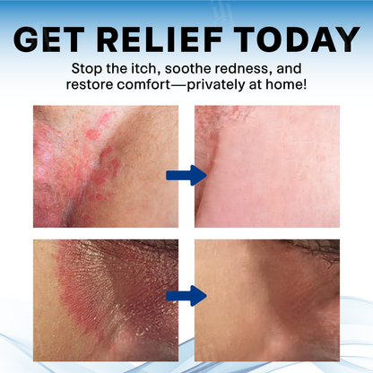 LBMLBM™ Scrotum Itchy Treatment Cream