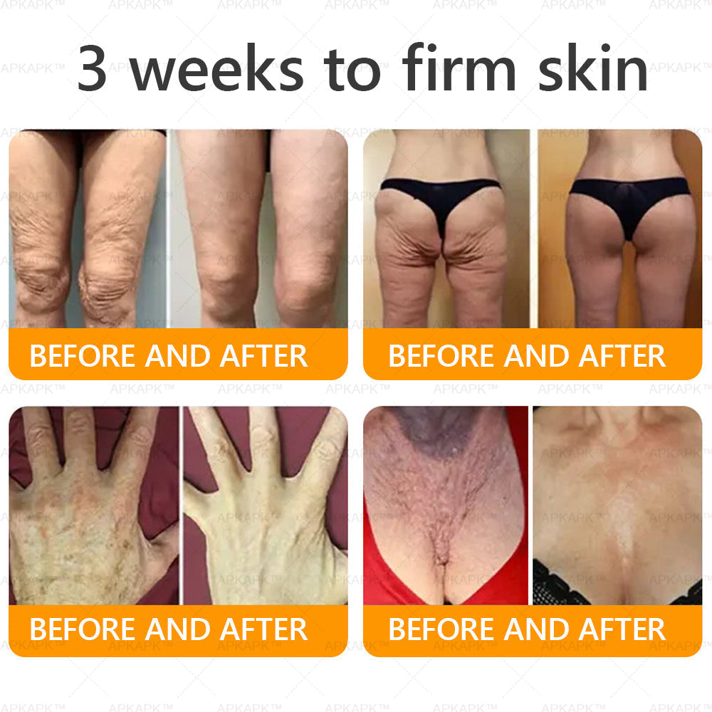 Made and Shipped from USA ✨ LBMLBM™ Bee venom Comprehensive Cream 🔥 LAST DAY 80% OFF）