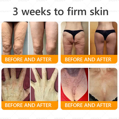 Made and Shipped from USA ✨ LBMLBM™ Bee venom Comprehensive Cream 🔥 LAST DAY 80% OFF）