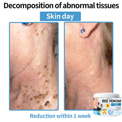 Seurico™ Bee Venom Multi-Symptom Skin Treatment Cream – Recommended by NPF for Targeted Skin Relief 🐝👨‍⚕️