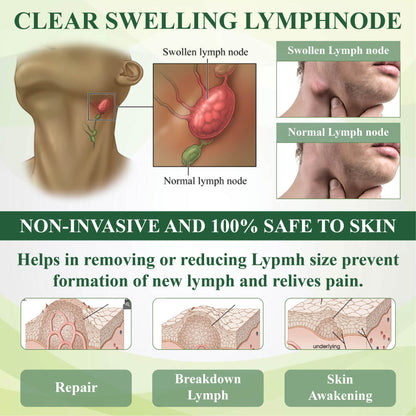 🏆ODEIUN™ CircuHerb Edema Soothing & Healing Balm | Instant Swelling Soothing • Vascular Care • Herbal Recovery ✨