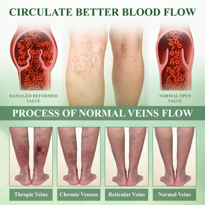 🏆ODEIUN™ CircuHerb Edema Soothing & Healing Balm | Instant Swelling Soothing • Vascular Care • Herbal Recovery ✨