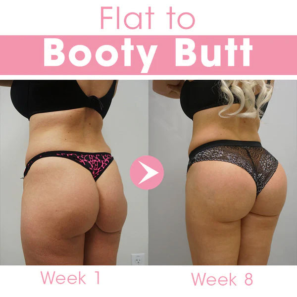 ✨ODEIUN™ ButtMax+ Enhancement Butt Cream 🍑 – Lift & Firm Boost