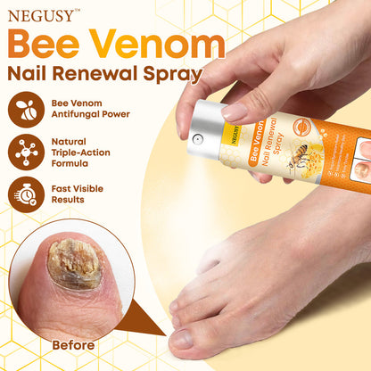 Negusy™ Bee Venom Nail Renewal Spray—Finish onychomycosis in 28 days! One spray restores healthy nails! 🦶 Effective for yellow, thick, brittle nails