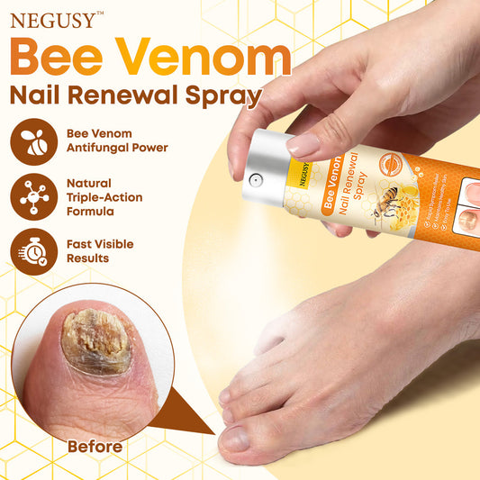 Negusy™ Bee Venom Nail Renewal Spray—Finish onychomycosis in 28 days! One spray restores healthy nails! 🦶 Effective for yellow, thick, brittle nails