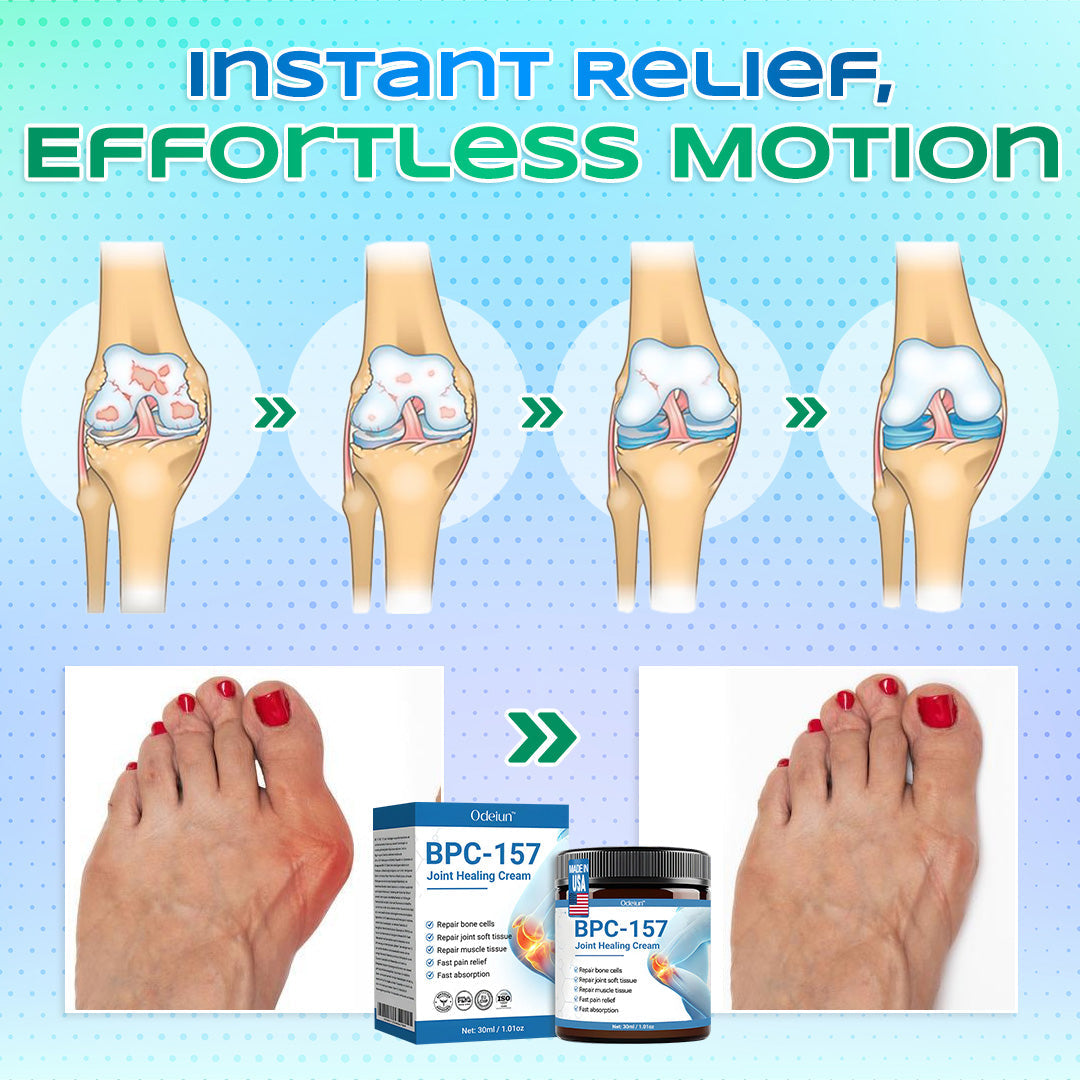 Advanced Relief: ODEIUN™ BPC-157 Joint Healing Cream🦴Treats Arthritis. Neuropathy. Rheumatism. Sports Injuries & More🦵