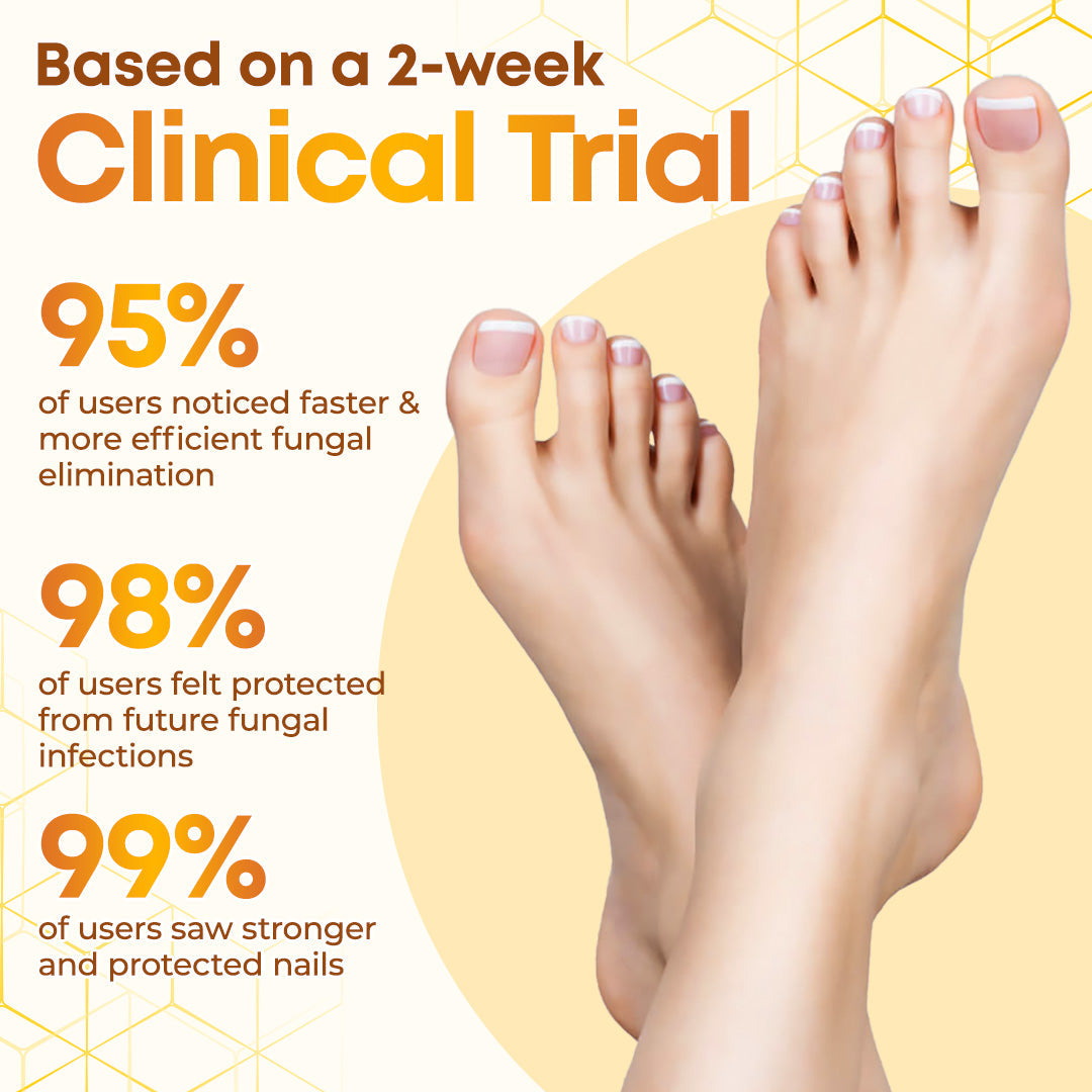 Negusy™ Bee Venom Nail Renewal Spray—Finish onychomycosis in 28 days! One spray restores healthy nails! 🦶 Effective for yellow, thick, brittle nails