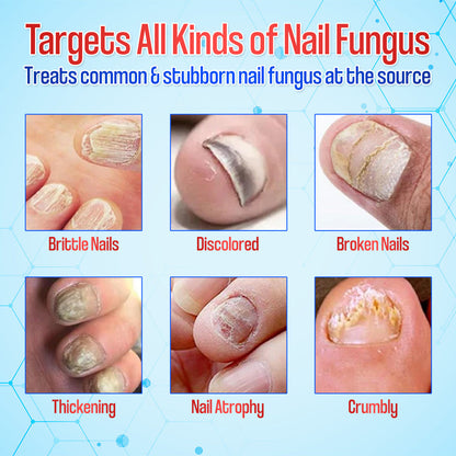 Zakdavi™ Anti-Fungal Nail Repair Patches✨ Say Goodbye to Nail Fungus in Days! 💅🍃