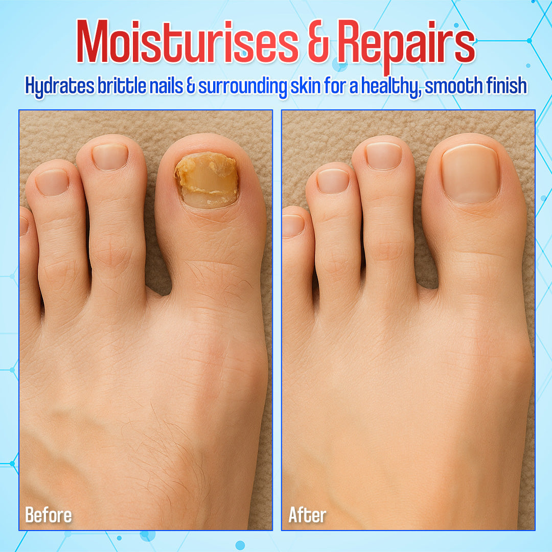 Zakdavi™ Anti-Fungal Nail Repair Patches✨ Say Goodbye to Nail Fungus in Days! 💅🍃