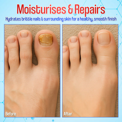 Zakdavi™ Anti-Fungal Nail Repair Patches✨ Say Goodbye to Nail Fungus in Days! 💅🍃