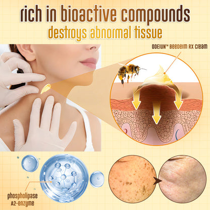 ✨ ODEIUN™ BeeDerm RX Cream – Natural Wart, Mole & Skin Tag Remover with Healing Bee Venom