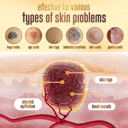 ✨ ODEIUN™ BeeDerm RX Cream – Natural Wart, Mole & Skin Tag Remover with Healing Bee Venom