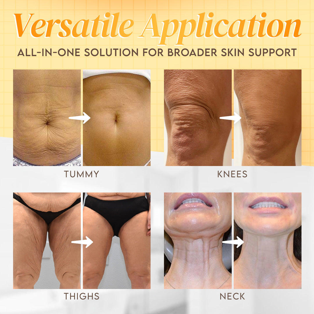 Made and Shipped from USA ✨ LBMLBM™ Bee venom Comprehensive Cream 🔥 LAST DAY 80% OFF）