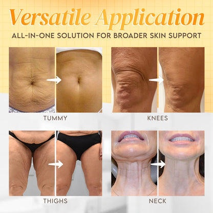 Made and Shipped from USA ✨ LBMLBM™ Bee venom Comprehensive Cream 🔥 LAST DAY 80% OFF）