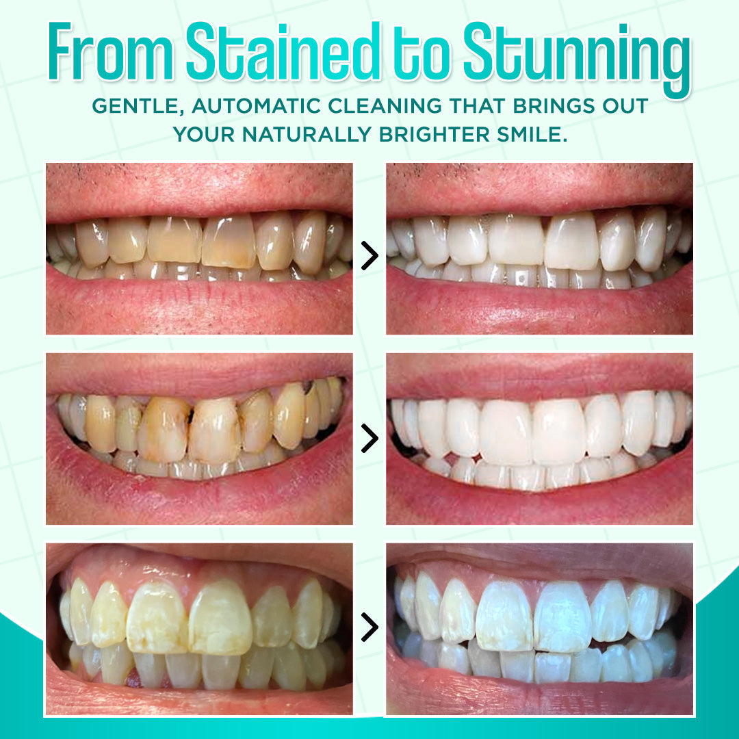 ✨ ODALT™ Self-Brushing Toothbrush – Effortless Deep Clean & Naturally Brighter Teeth