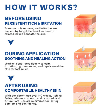 LBMLBM™ Scrotum Itchy Treatment Cream